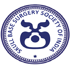 SBSSI
